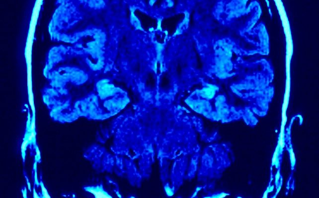 Which Brain Are You Using?